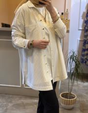 ghisa çizgili tunik ekru 3